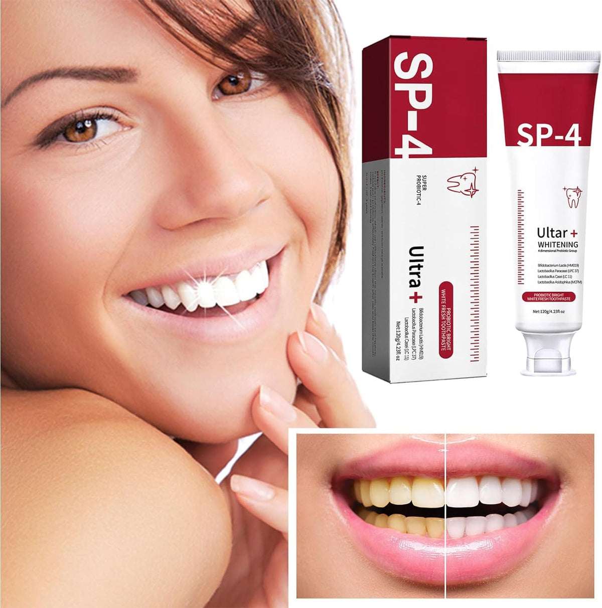 SP-4 Probiotic Whitening Toothpaste - Buy 1 Get 1 Free 🎁✨